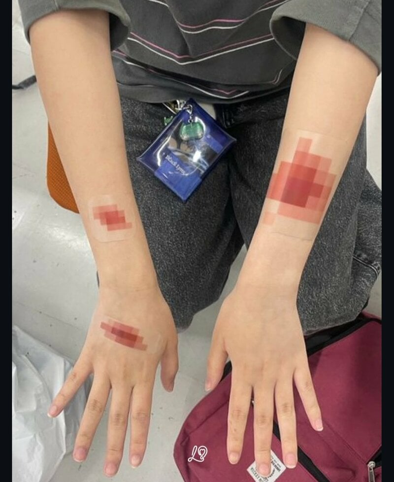 A person applying bandages with a mosaic pattern printed on them to their arm and the back of their hand.