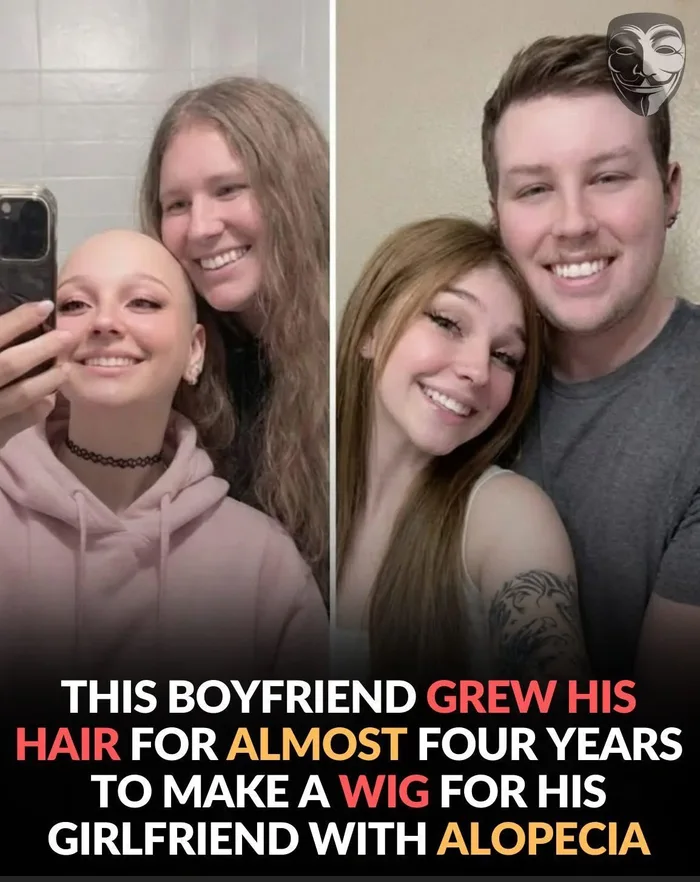 Before-and-after comparison of a couple: the left photo shows the bald girlfriend with her long-haired boyfriend, and the right shows her wearing a wig made from his donated hair after he cut it short.