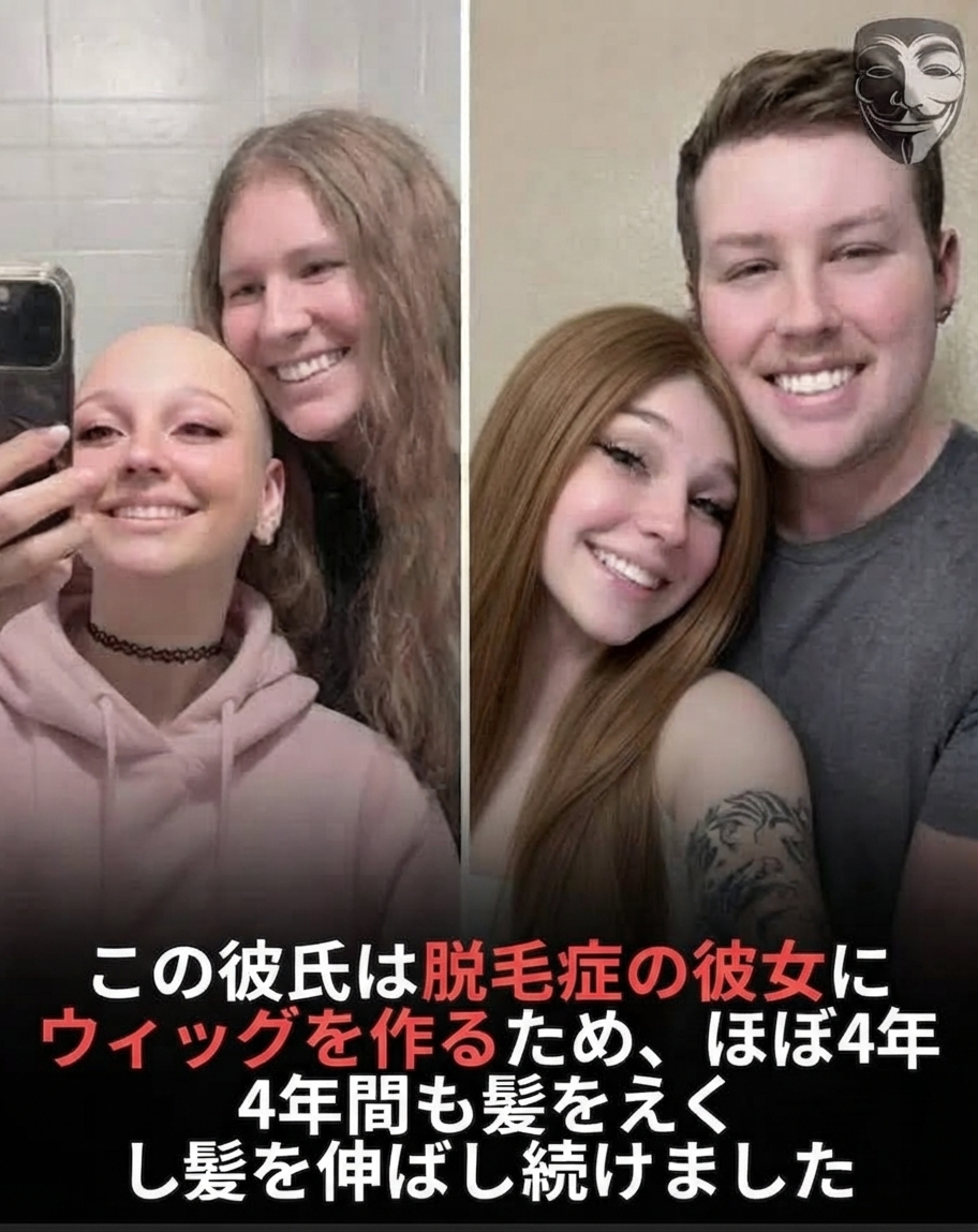 カップルのビフォーアフター比較写真。左の写真にはスキンヘッドの彼女と長髪の彼氏、右の写真には短髪になった彼氏から寄付された髪で作られたウィッグを着けた彼女が写っている。